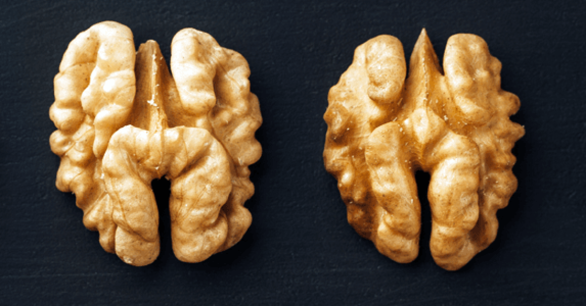 Ανακαλύψτε γιατί η premium ελληνική καρυδόψιχα απογειώνει τις πωλήσεις σας. Ποιότητα, γεύση και αξιοπιστία για τη ζαχαροπλαστική και το λιανεμπόριο.